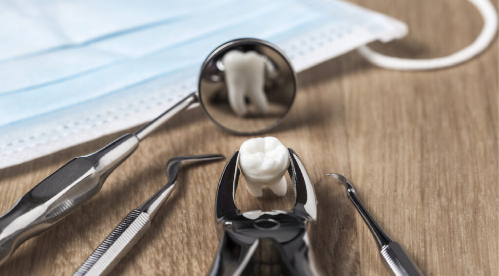 Tooth Extraction in Dubai