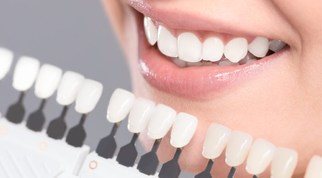 Cosmetic Dentistry in Dubai
