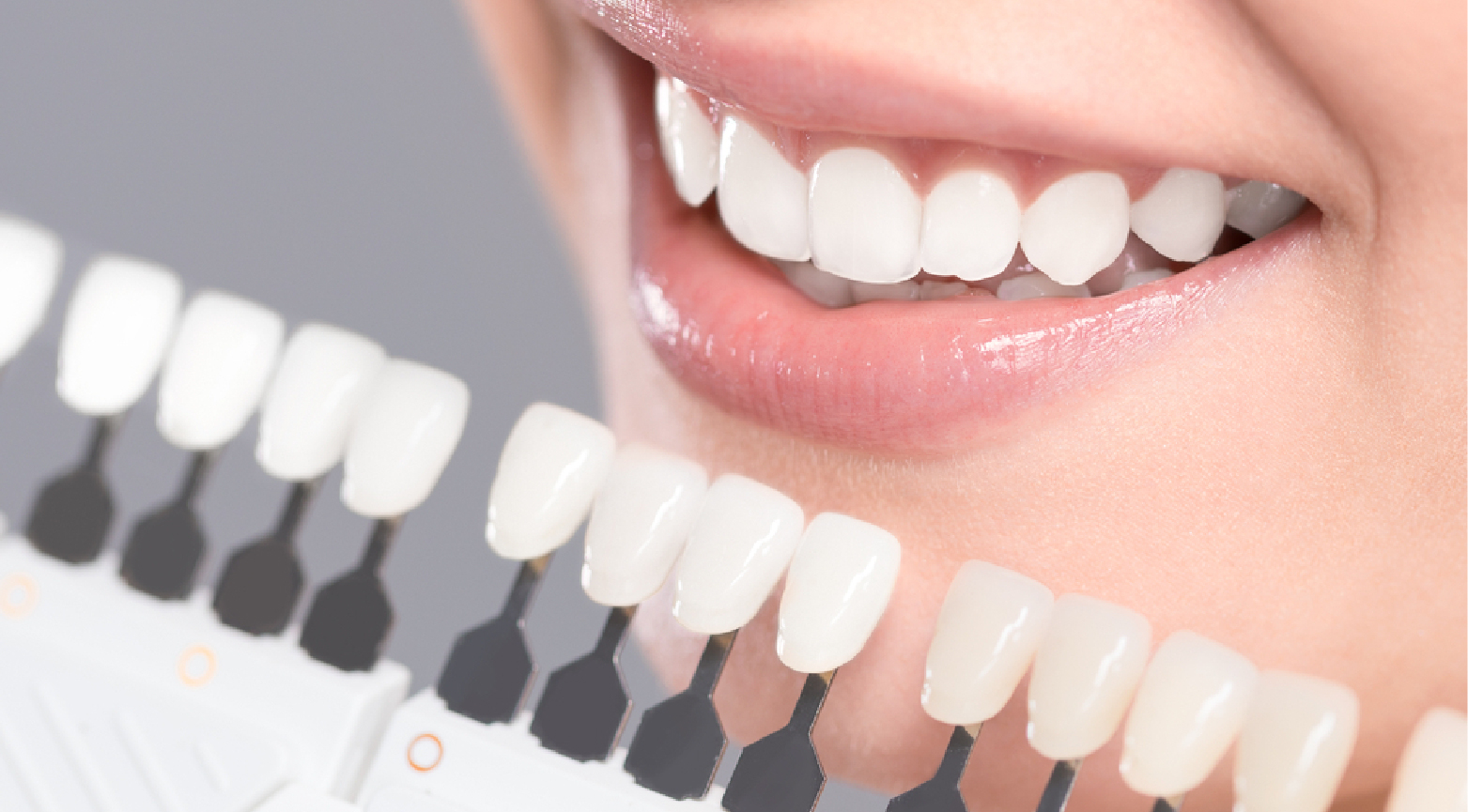 Cosmetic Dentistry in Dubai
