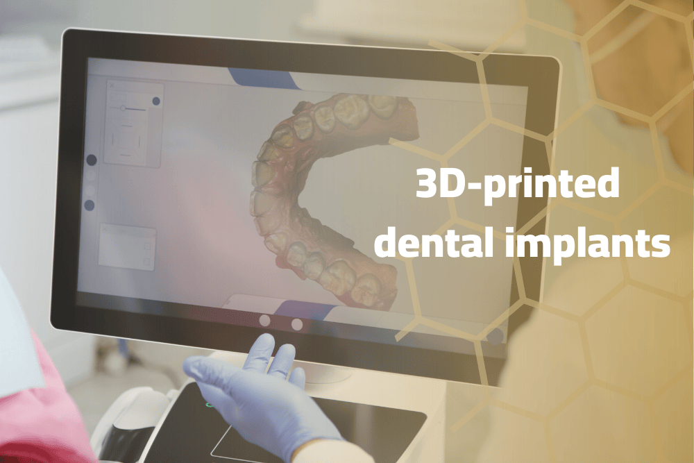 3D Printed Dental Implants:Revolutionizing Dental Care
