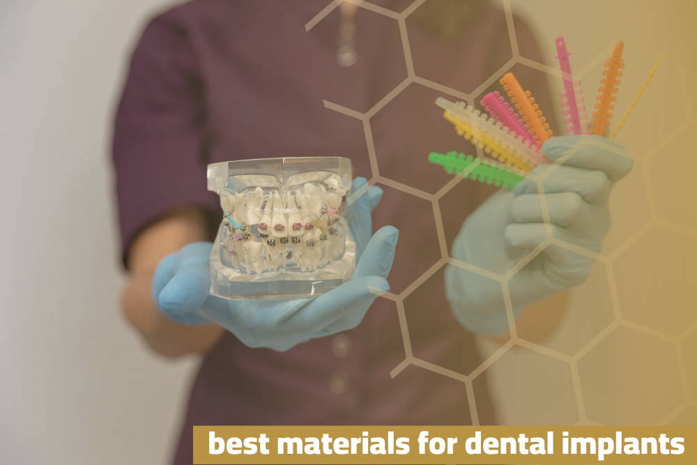 The Best Materials For Dental Implants: Ensure Quality and Efficiency of Treatment