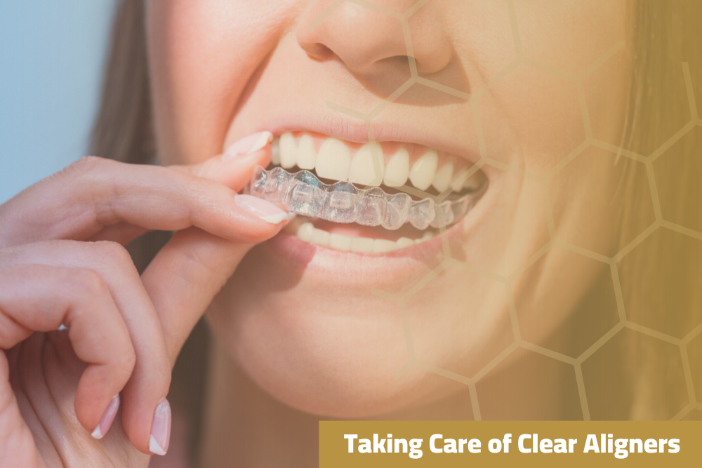 Taking Care of Clear Aligners: Practical Steps 