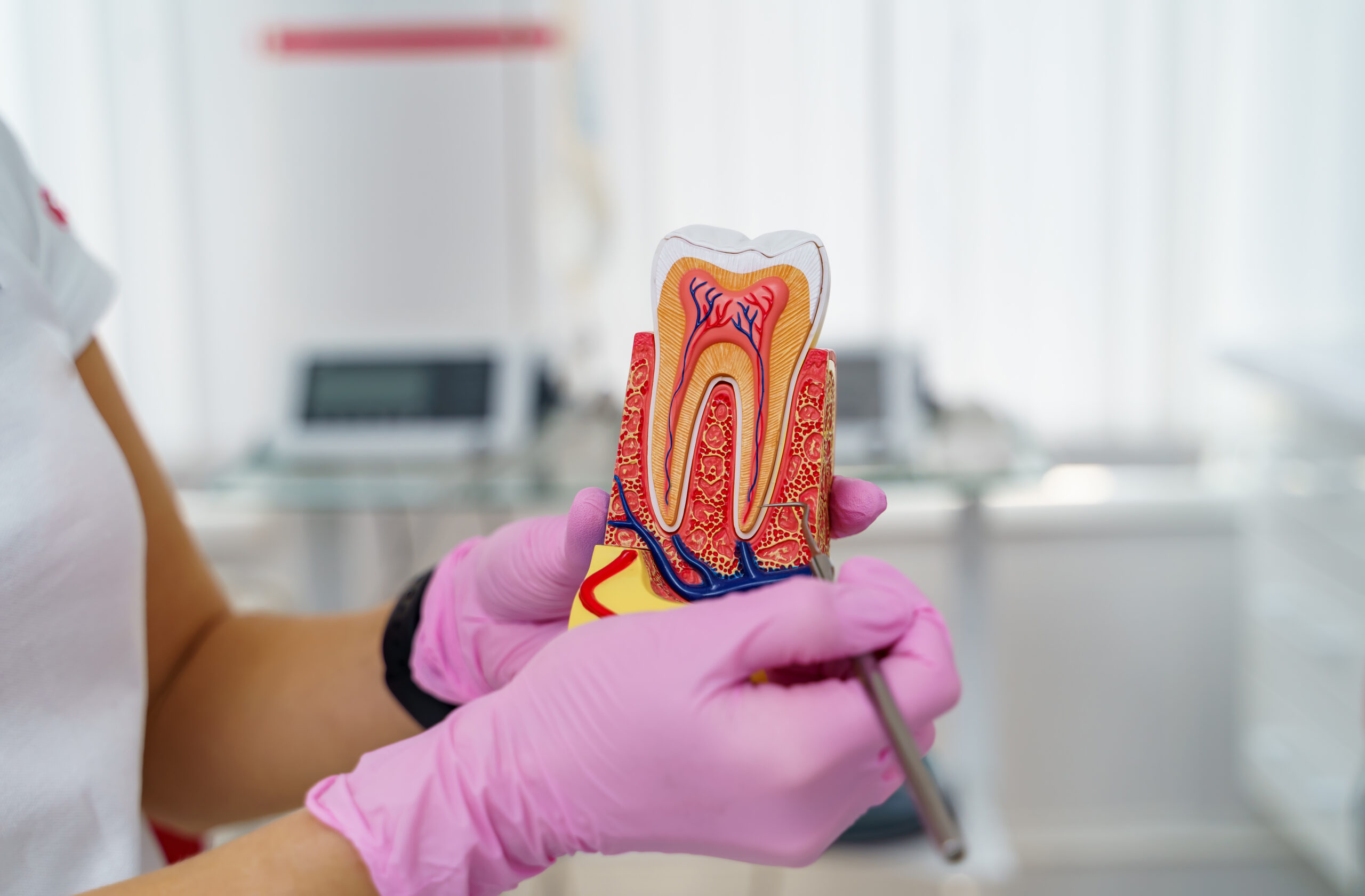 endodontic treatment dubai