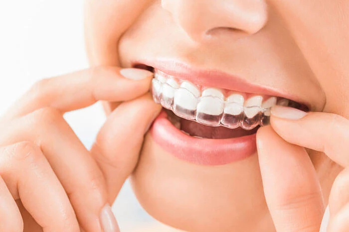 A perfectly aligned smile is no longer just a dream. 