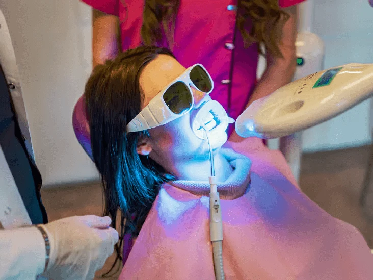 Top 5 Benefits of Professional Teeth Whitening at a Dental Clinic in Dubai